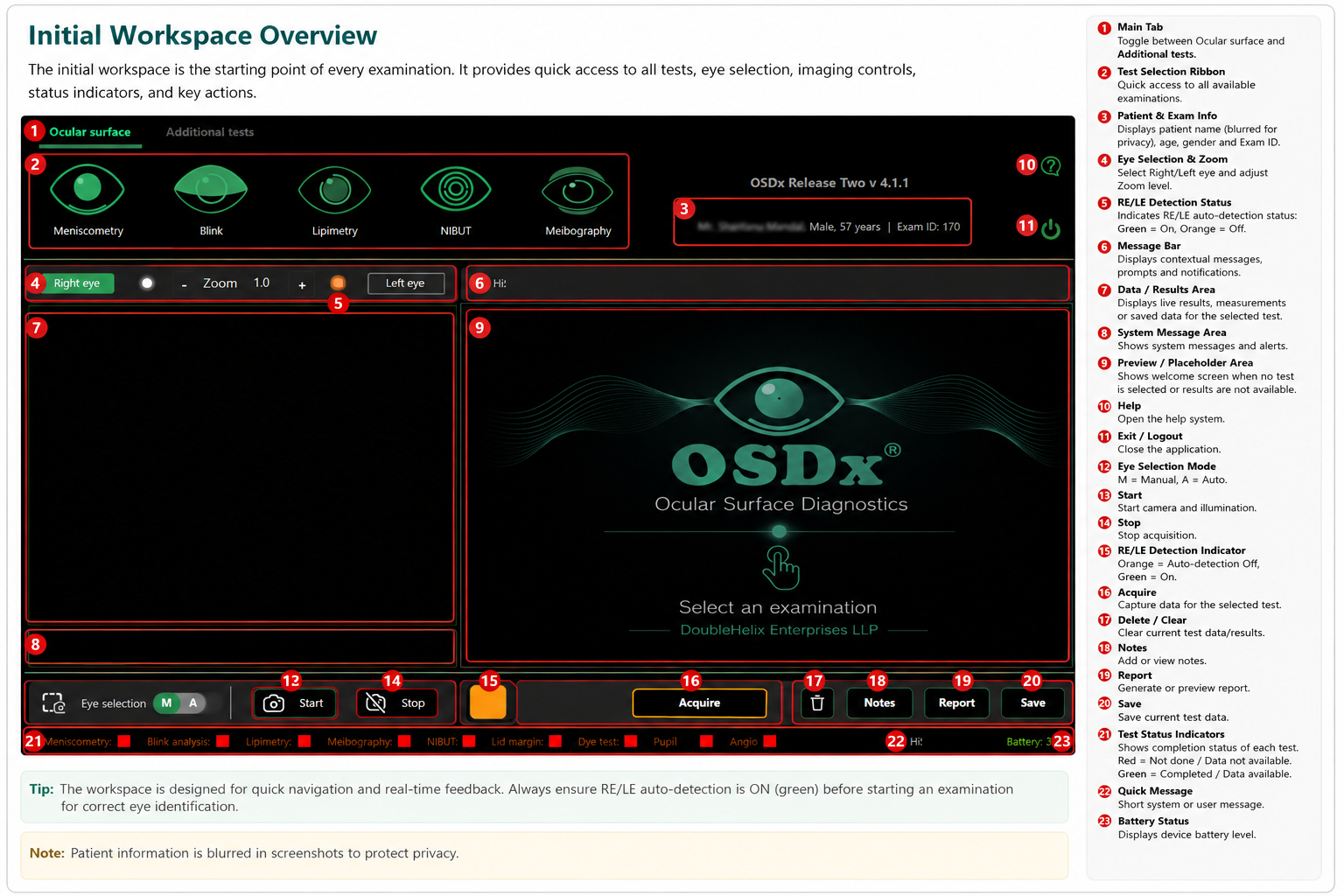 Annotated OSDx initial workspace