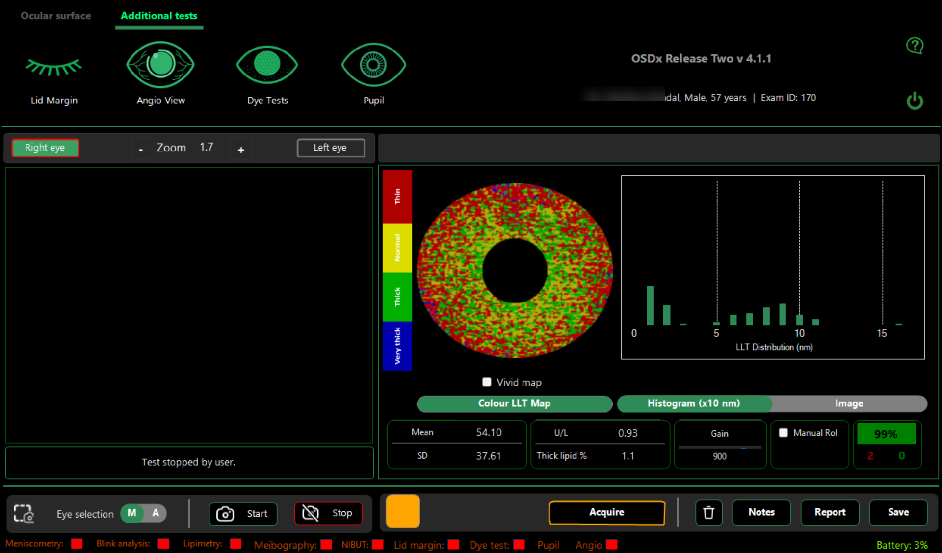 OSDx Lipimetry results screen showing colour LLT map and histogram