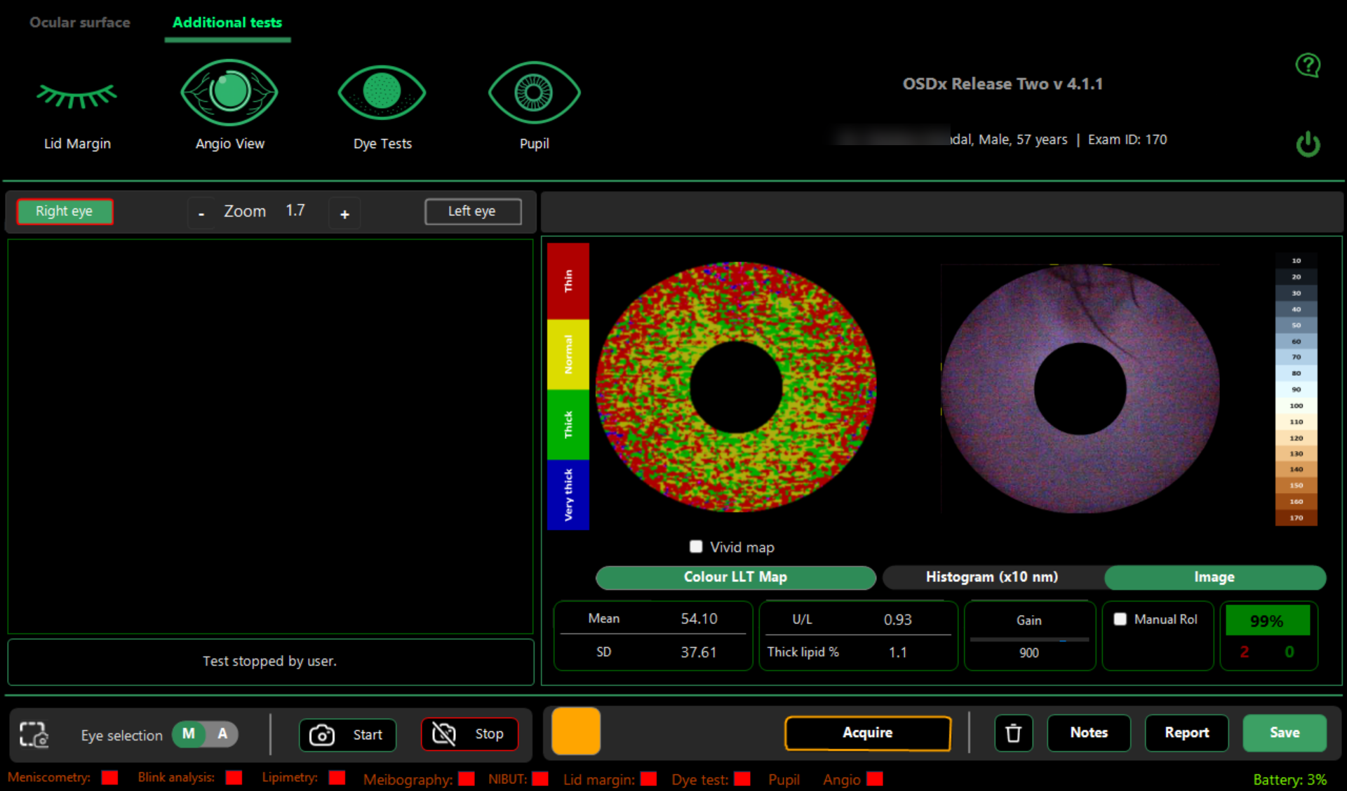 OSDx Lipimetry results screen showing colour LLT map and tear-film image